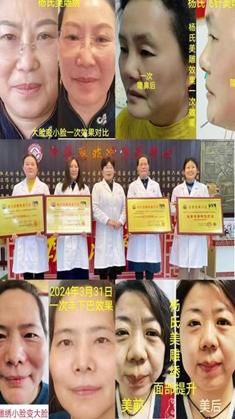 優(yōu) 秀學(xué)員事例(濰坊奎文區(qū)陳愛菊)