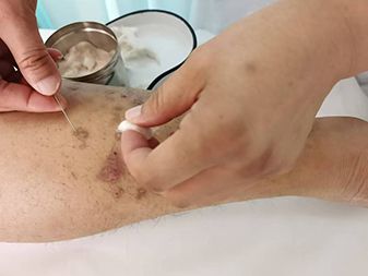 優(yōu) 秀學(xué)員事例(濰坊奎文區(qū)陳愛菊)