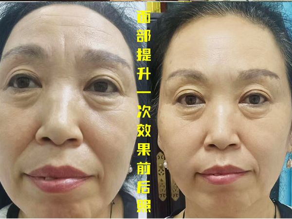 楊氏美雕專業(yè)