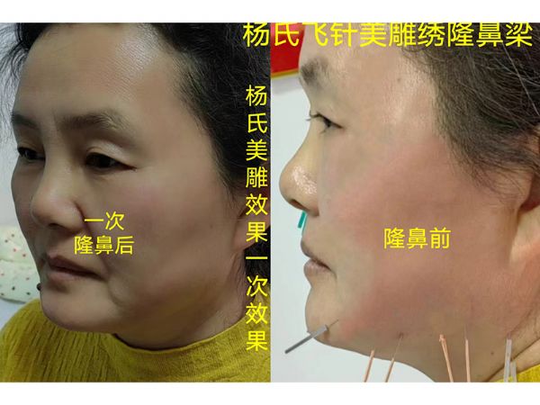 楊氏美雕專業(yè)