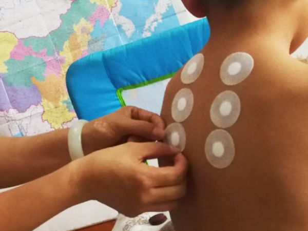 穴位貼敷專業(yè)